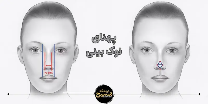 بینی گوشتی یا استخوانی؟ چطور تشخیص بدهیم؟ 4 پهنای نوک بینی
