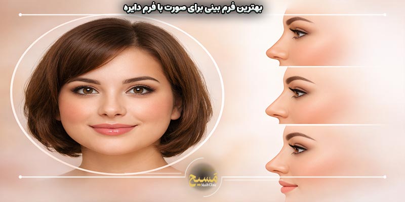 چه مدل بینی به صورت پهن میاد 1 بهترین فرم بینی برای صورت با فرم دایره