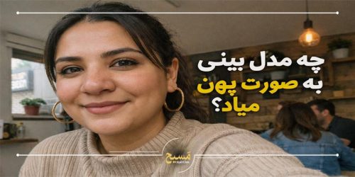چه مدل بینی به صورت پهن میاد
