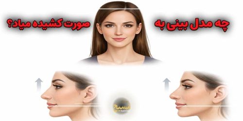 چه مدل بینی به صورت کشیده میاد؟