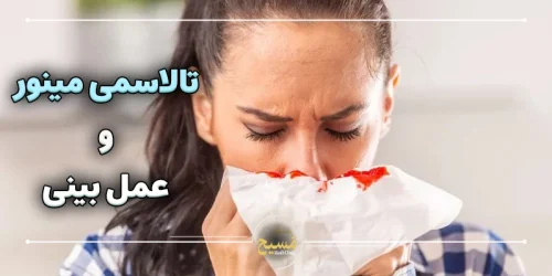 تالاسمی مینور و عمل بینی