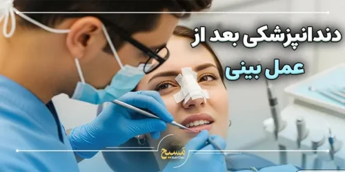 دندانپزشکی بعد از عمل بینی