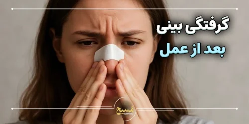 گرفتگی بینی بعد از عمل